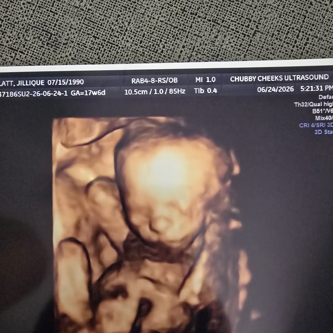 Photo shared by Jillique for their Babylist baby registry.