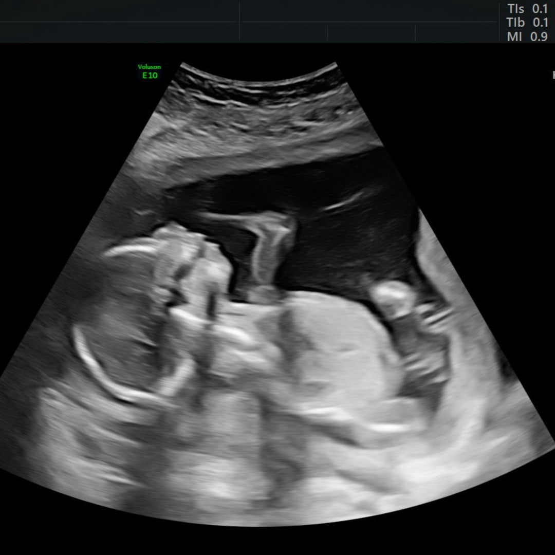 Photo shared by Dianne for their Babylist baby registry.