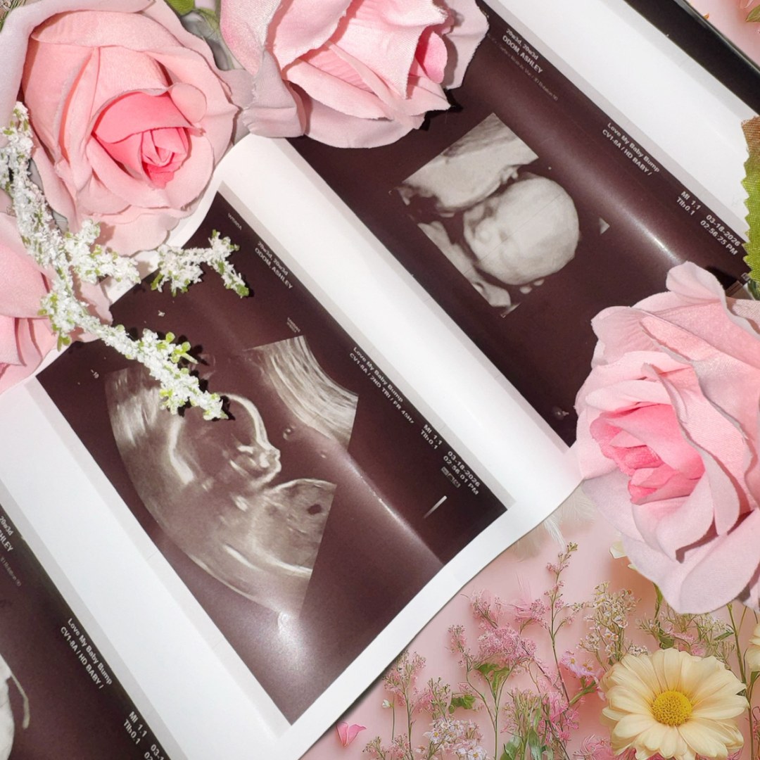Photo shared by Ashley for their Babylist baby registry.