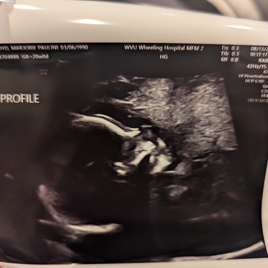 Photo shared by Marjorie for their Babylist baby registry.