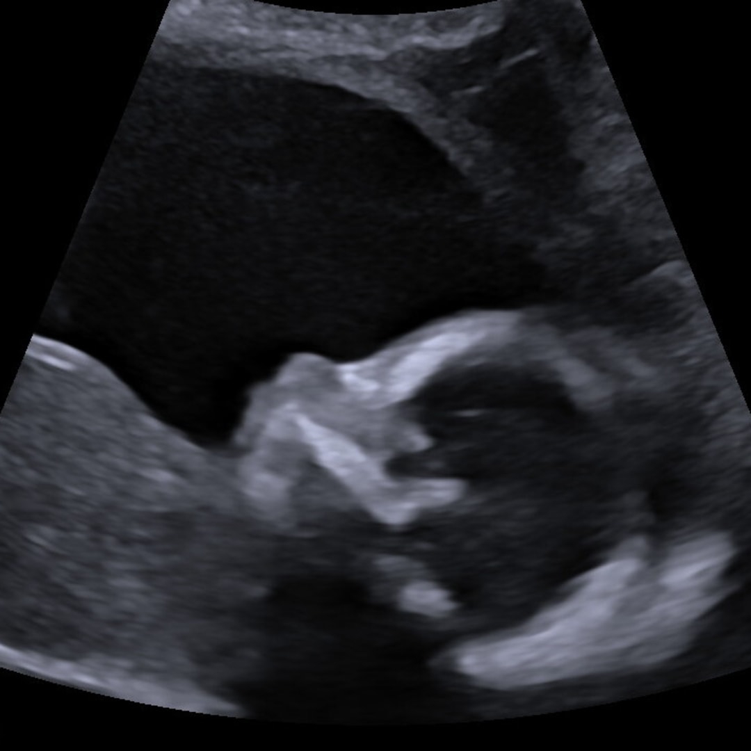 Photo shared by Whitney for their Babylist baby registry.
