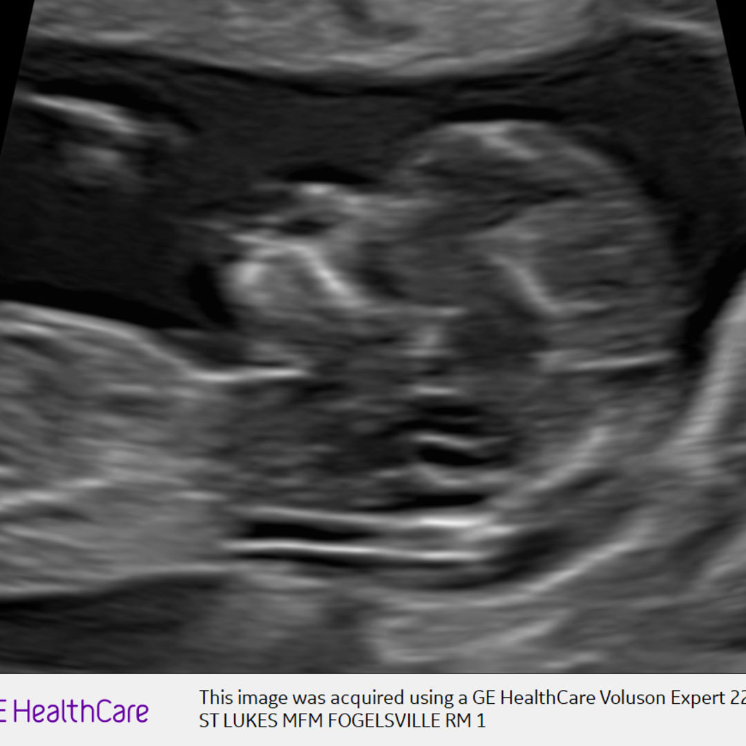 Photo shared by Lindsay for their Babylist baby registry.