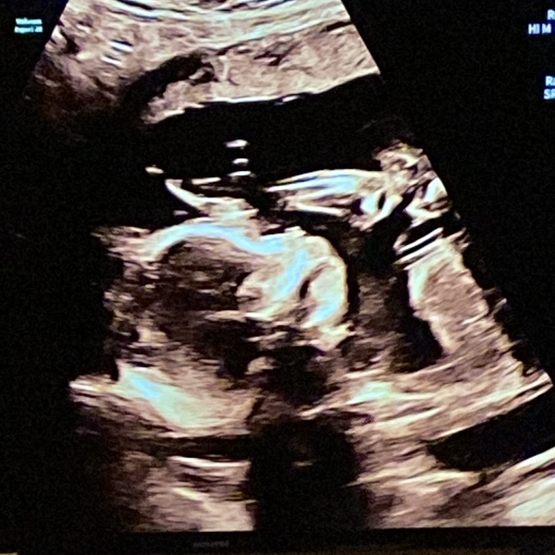 Photo shared by Mocca for their Babylist baby registry.