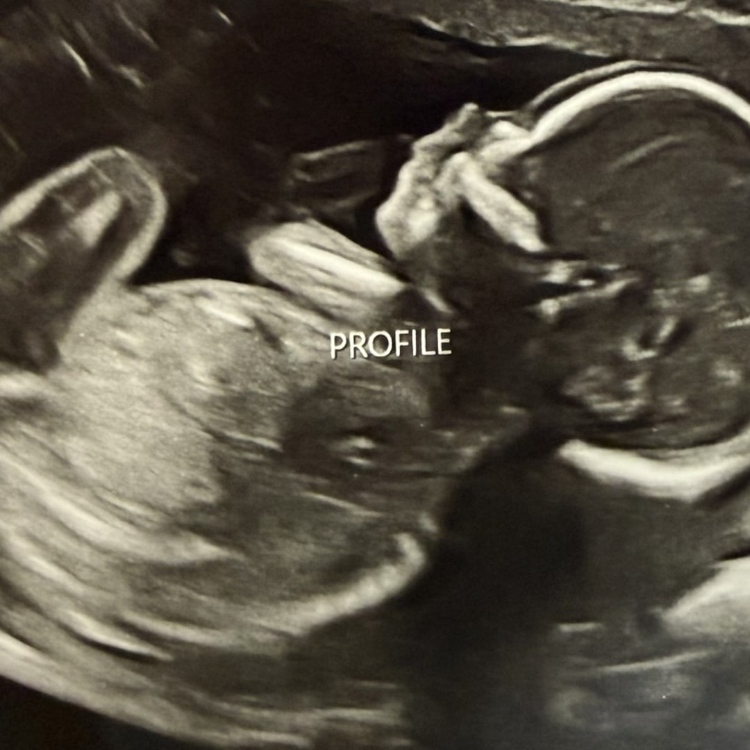 Photo shared by Caitlin for their Babylist baby registry.