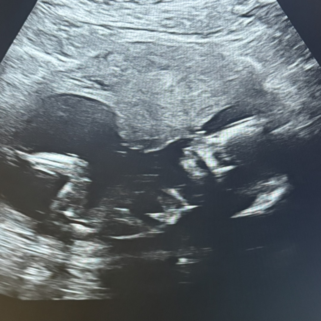 Photo shared by Chelsea for their Babylist baby registry.