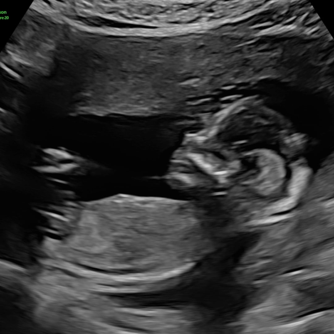 Photo shared by Emily for their Babylist baby registry.