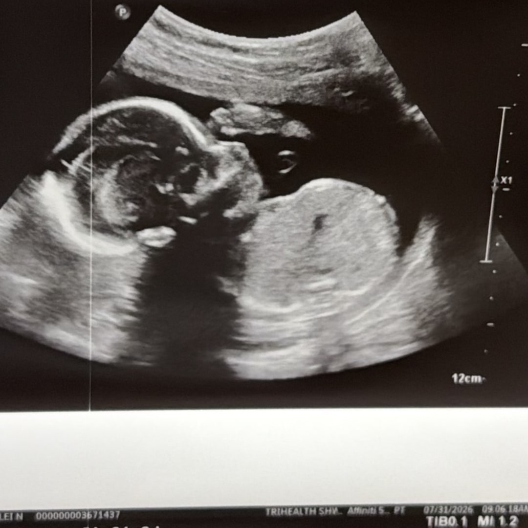 Photo shared by Ranlei for their Babylist baby registry.