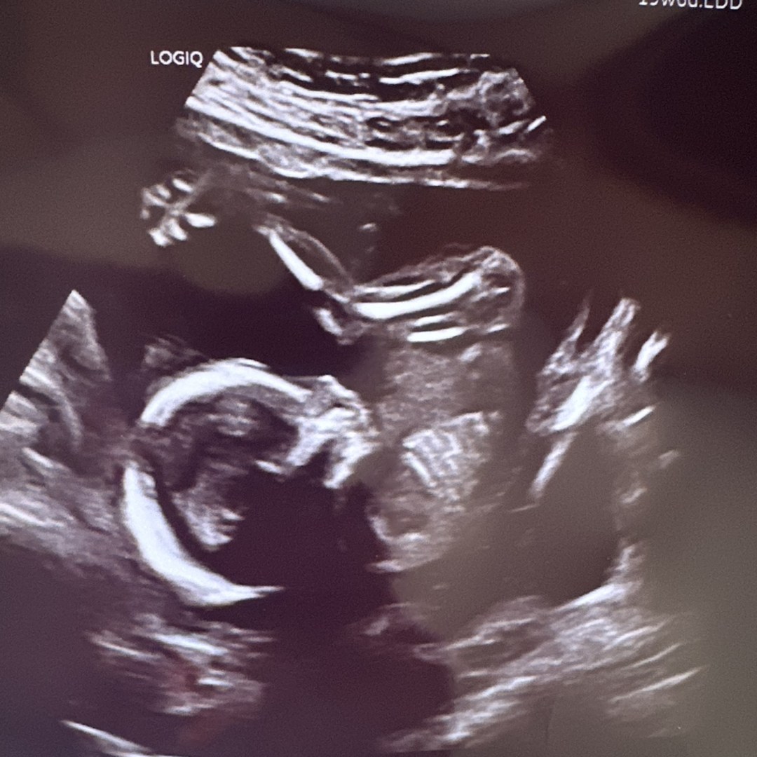 Photo shared by Kay for their Babylist baby registry.