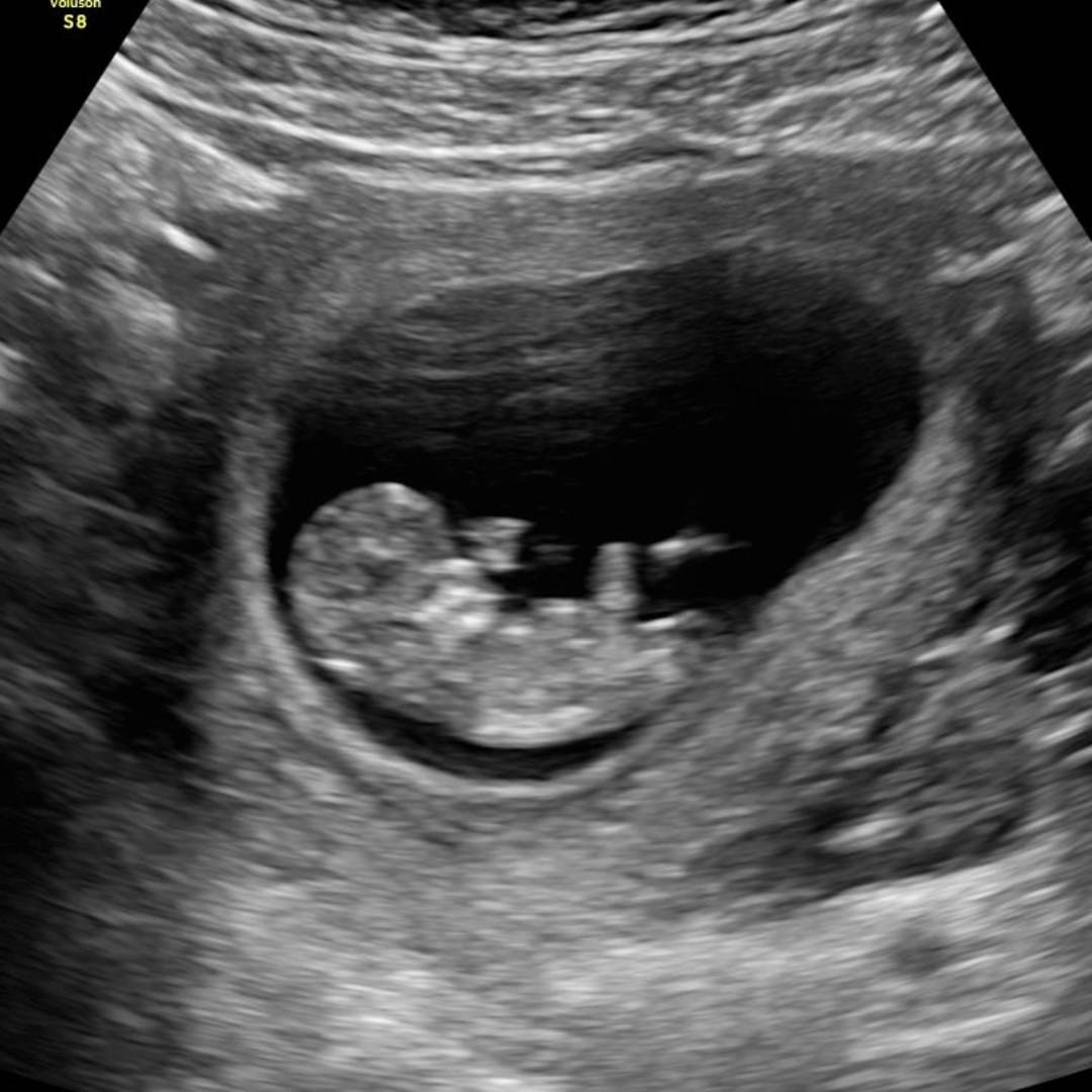 Photo shared by Paola for their Babylist baby registry.