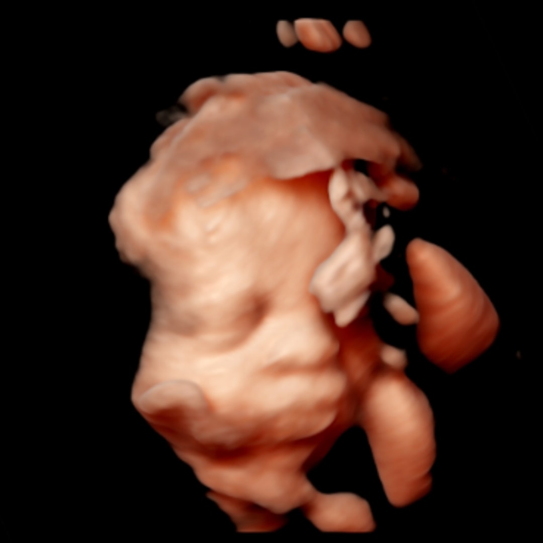 Photo shared by Ashlee for their Babylist baby registry.