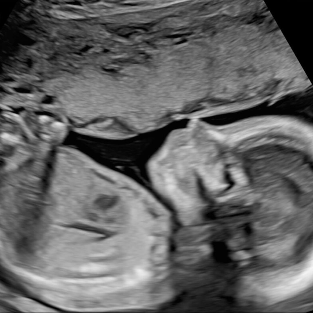 Photo shared by Jilian for their Babylist baby registry.