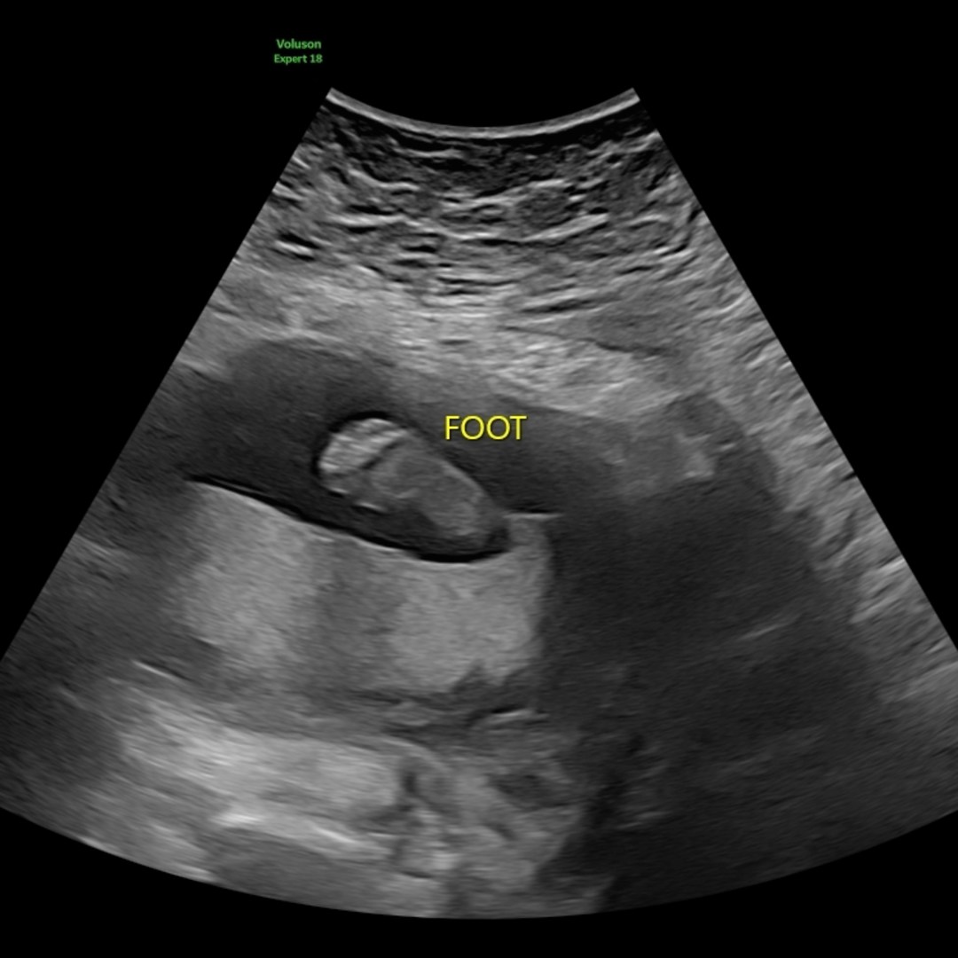 Photo shared by Alicia for their Babylist baby registry.