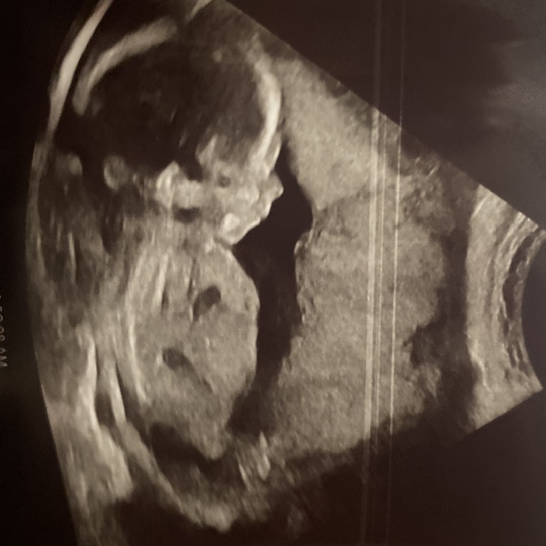 Photo shared by Deanna for their Babylist baby registry.