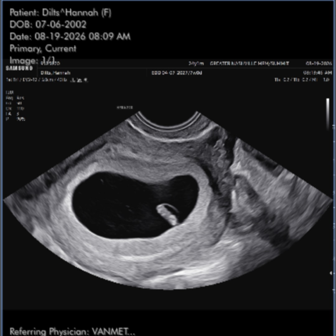 Photo shared by Hannah for their Babylist baby registry.