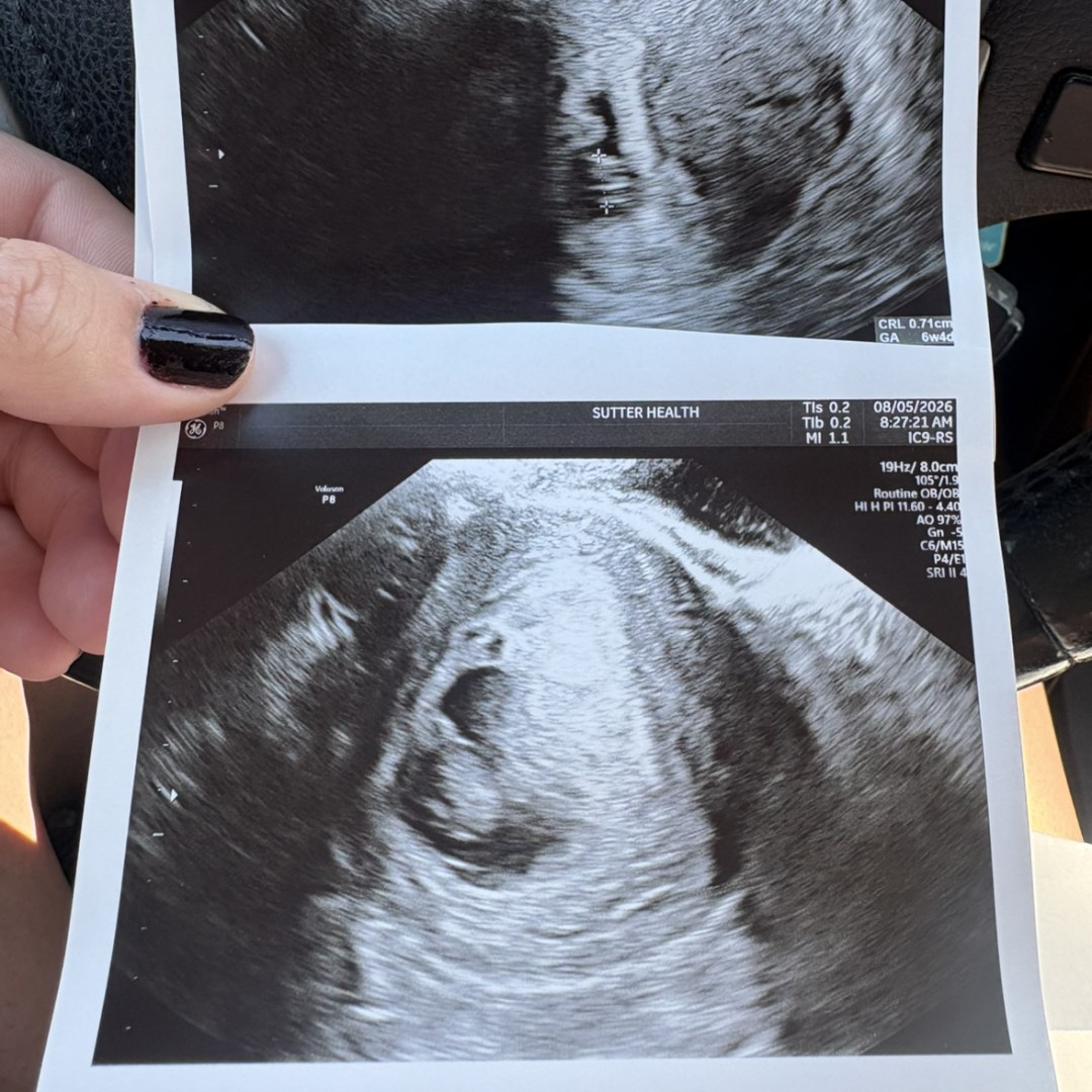 Photo shared by Emily for their Babylist baby registry.
