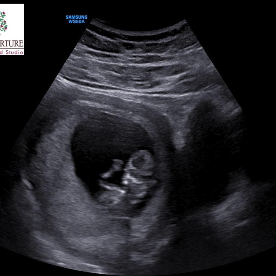 Photo shared by Nathalie for their Babylist baby registry.