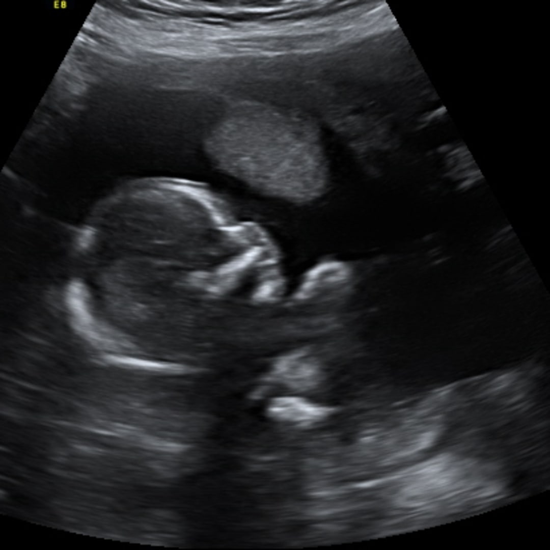 Photo shared by Amanda for their Babylist baby registry.