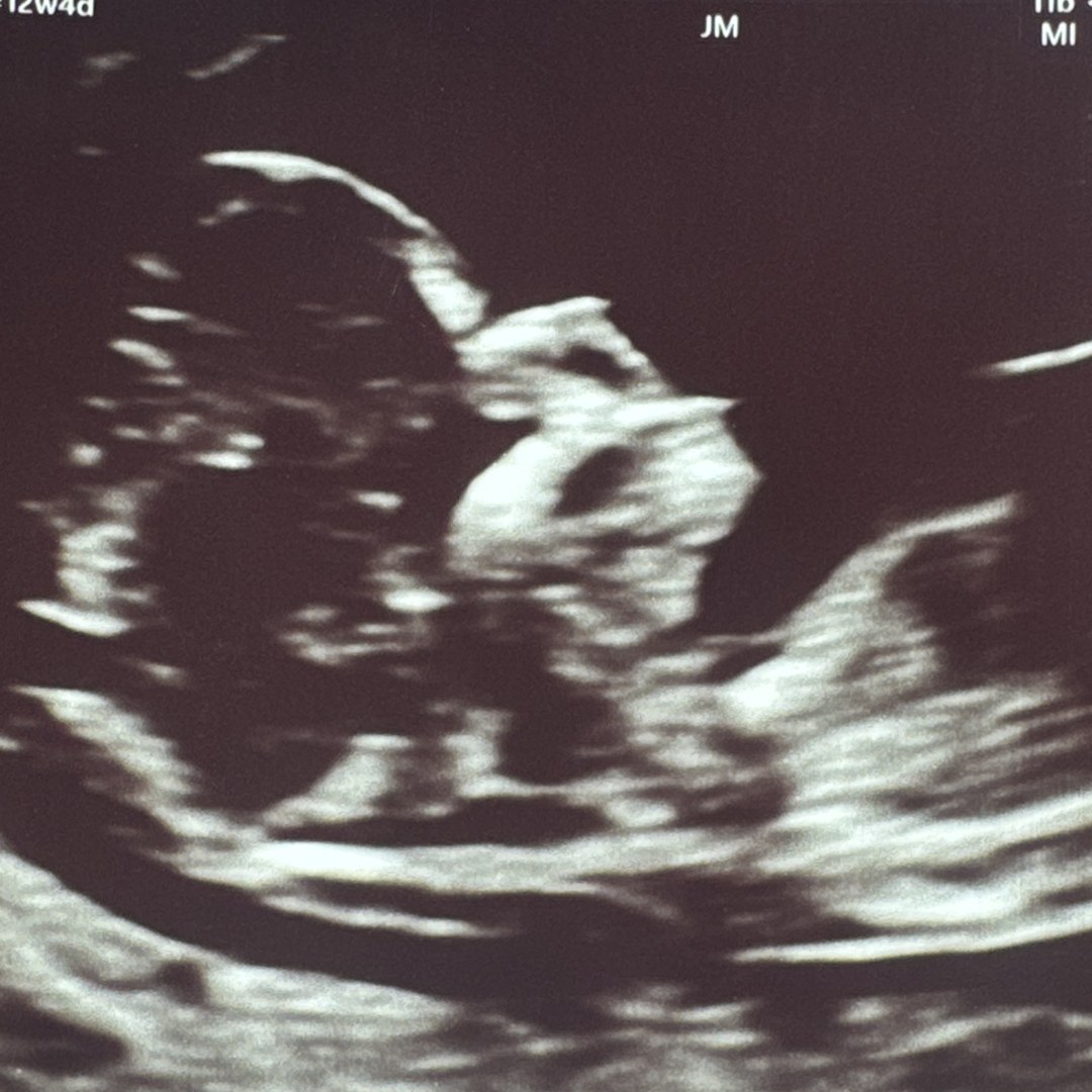 Photo shared by Courtney for their Babylist baby registry.