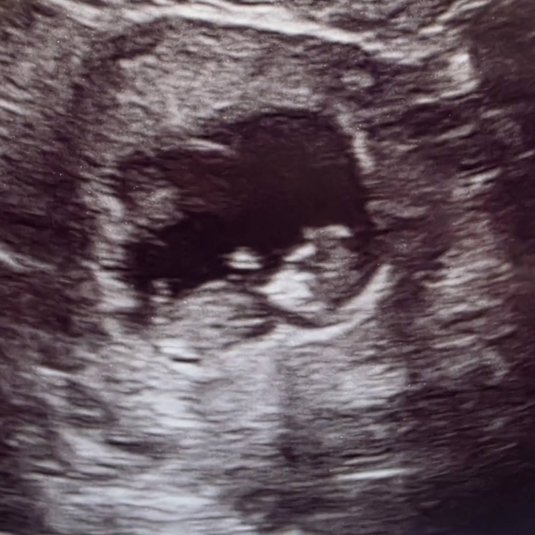 Photo shared by Daultyn for their Babylist baby registry.