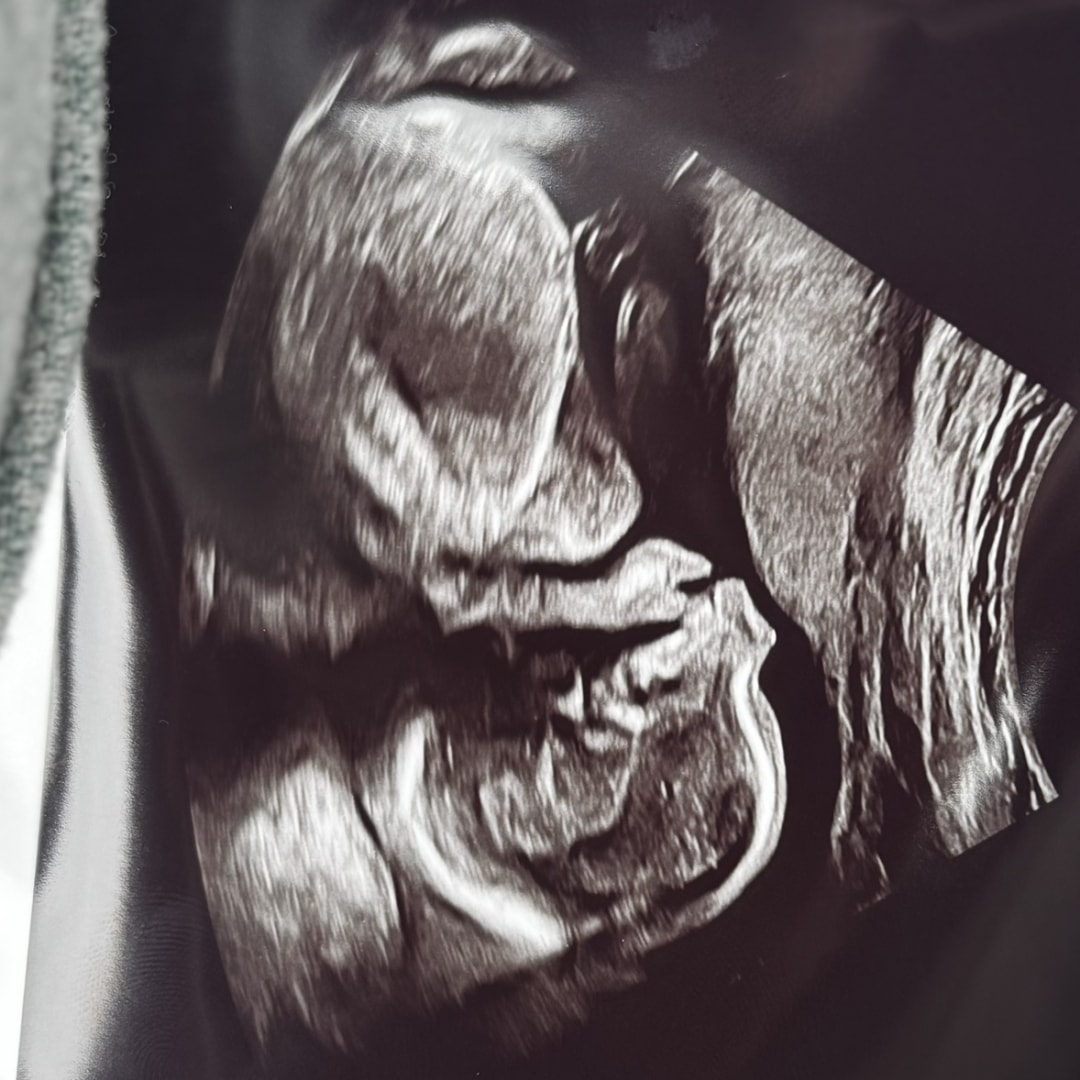 Photo shared by Katlynn for their Babylist baby registry.