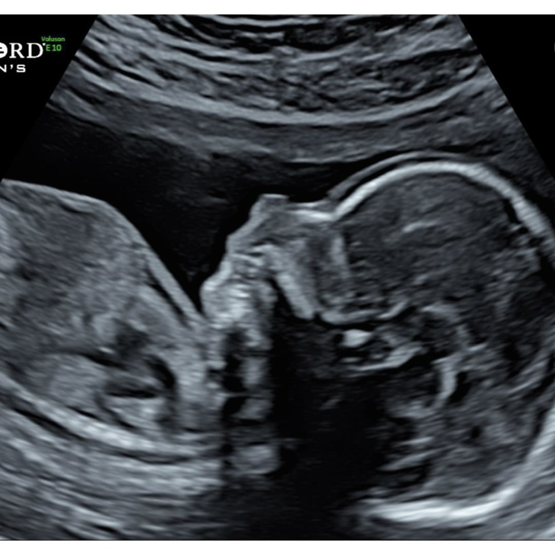 Photo shared by Kim for their Babylist baby registry.