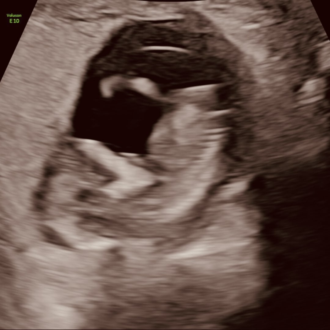 Photo shared by Sheyna for their Babylist baby registry.