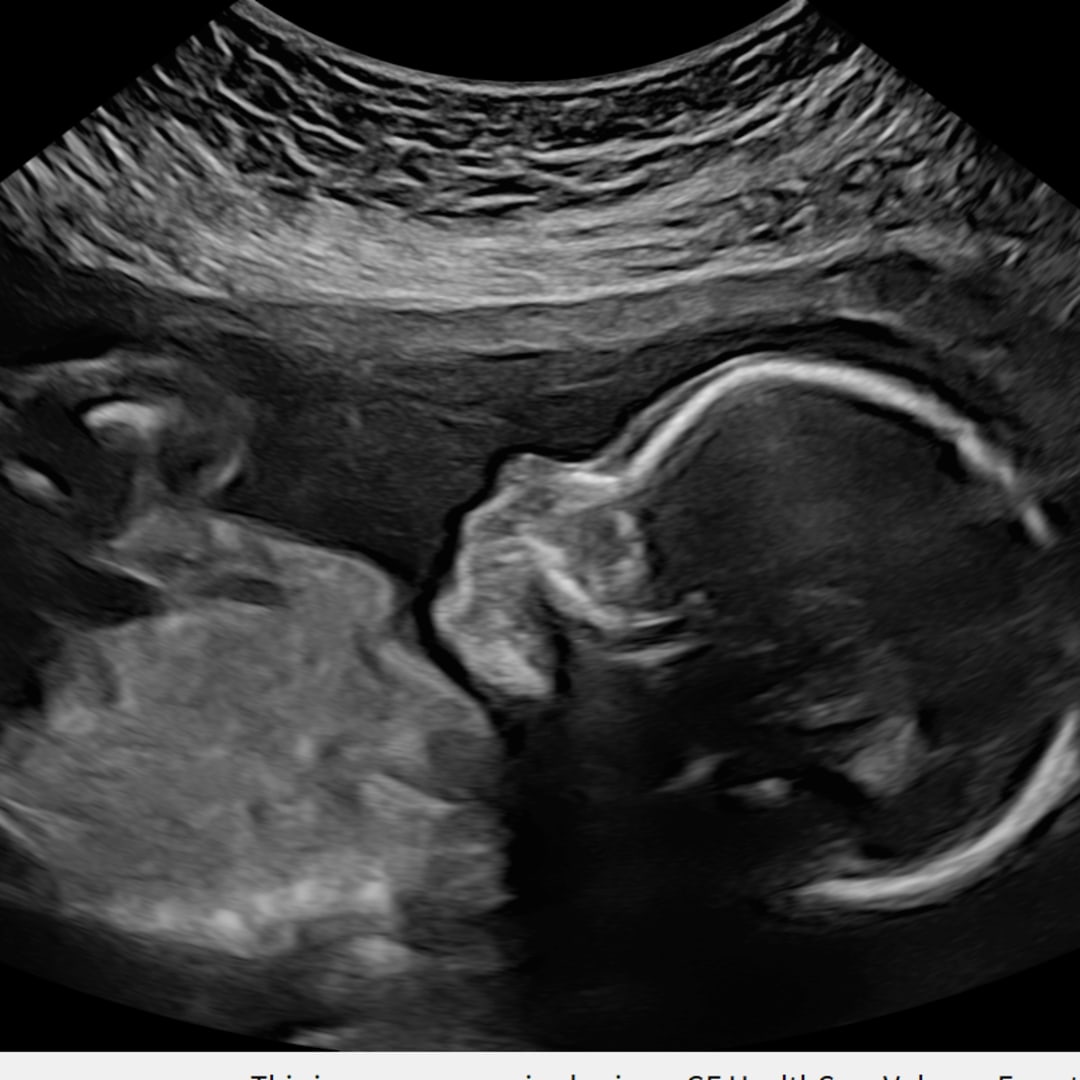 Photo shared by Stephanie for their Babylist baby registry.