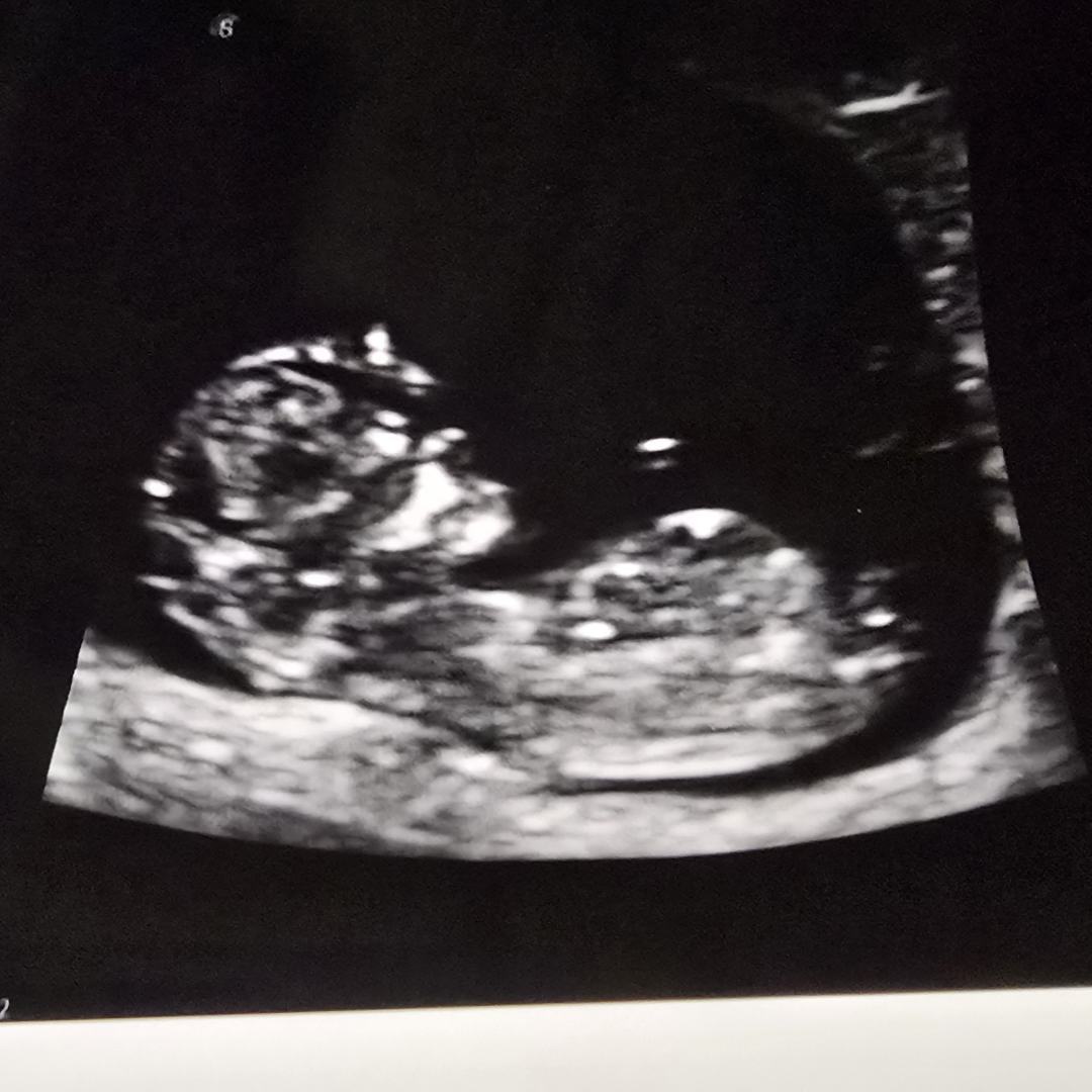 Photo shared by Kristen for their Babylist baby registry.