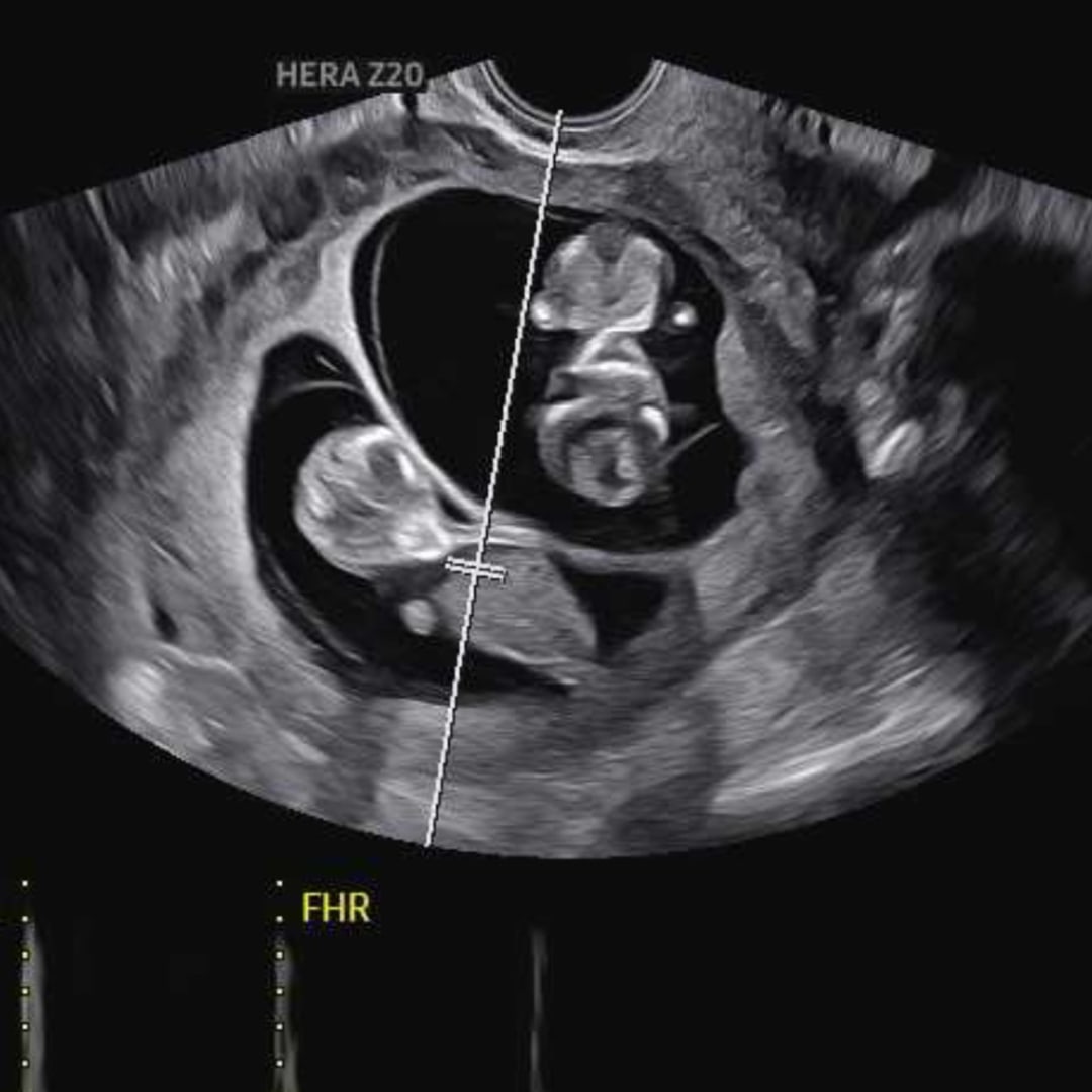 Photo shared by Kia for their Babylist baby registry.