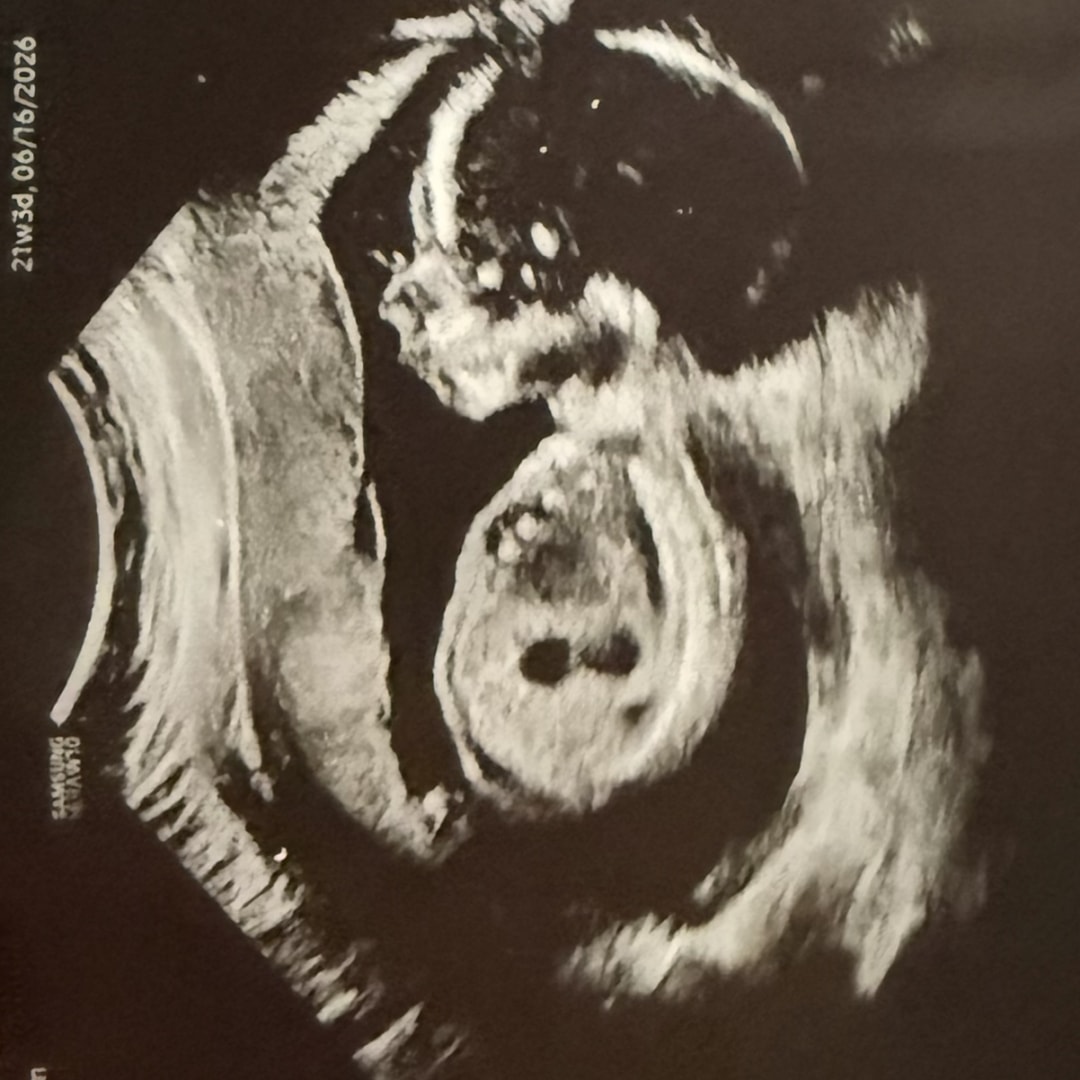 Photo shared by Samantha for their Babylist baby registry.