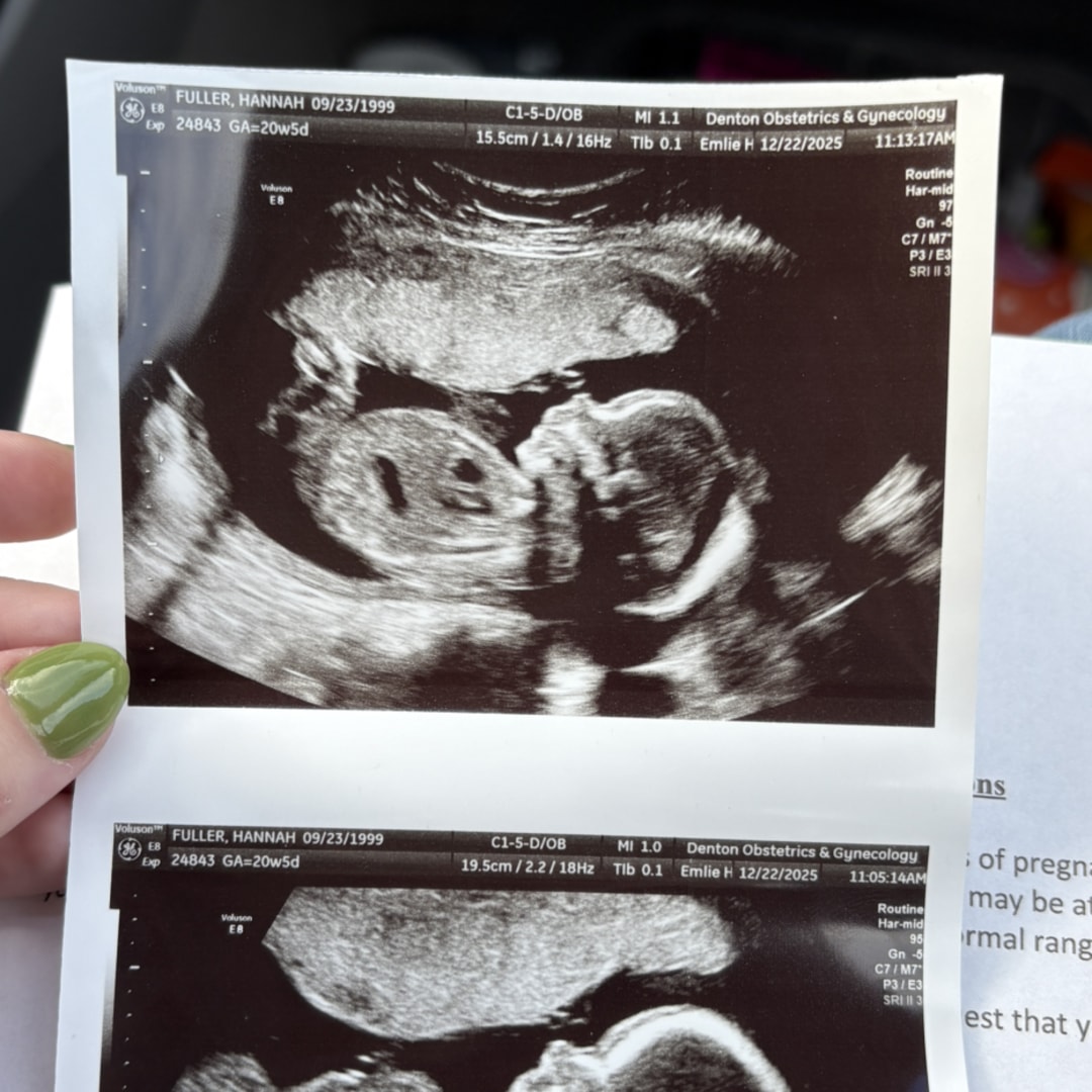 Photo shared by Hannah for their Babylist baby registry.