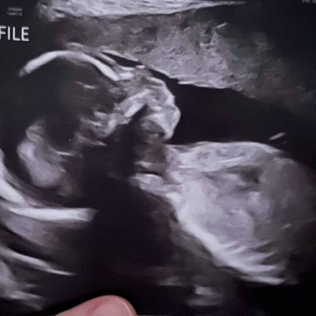 Photo shared by Jessica for their Babylist baby registry.