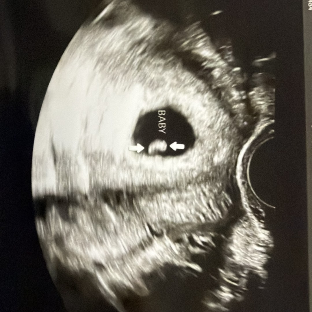 Photo shared by Avery for their Babylist baby registry.