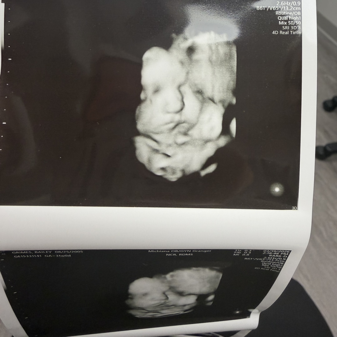 Photo shared by Bailey for their Babylist baby registry.