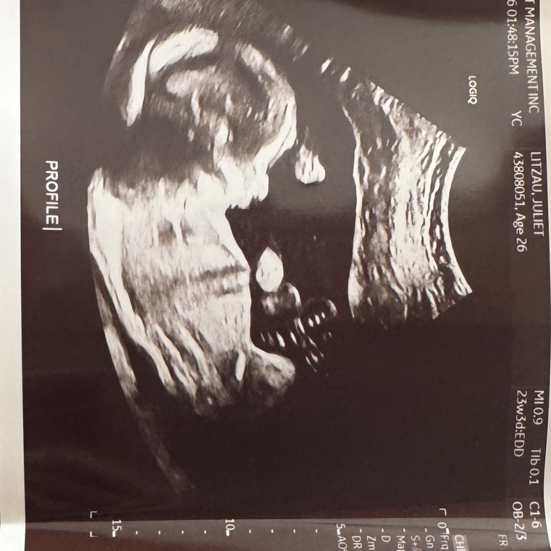 Photo shared by Juliet for their Babylist baby registry.