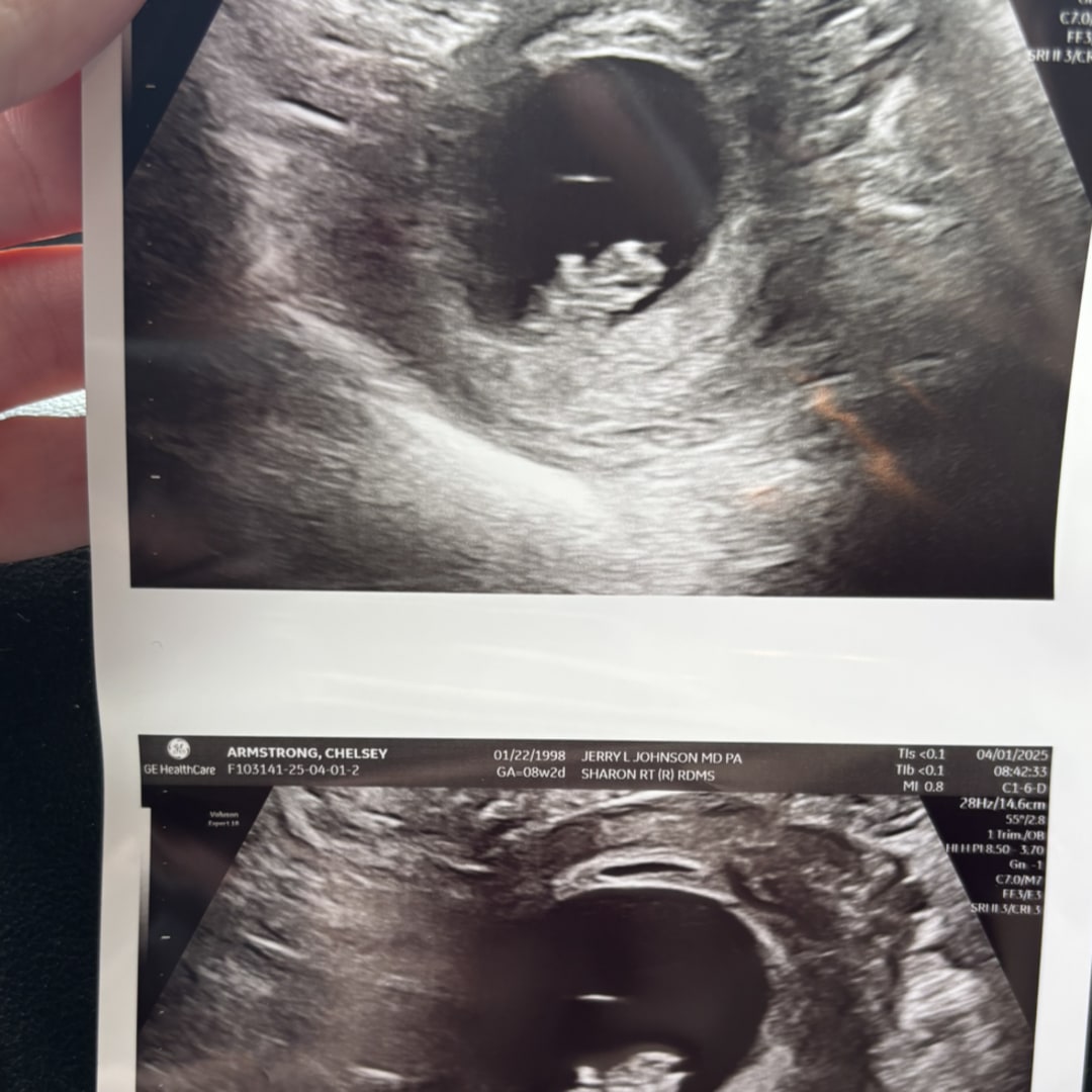 Photo shared by Chelsey for their Babylist baby registry.