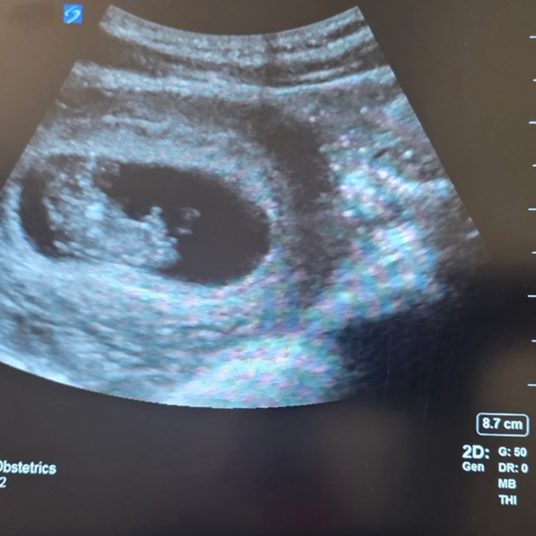 Photo shared by Akita for their Babylist baby registry.