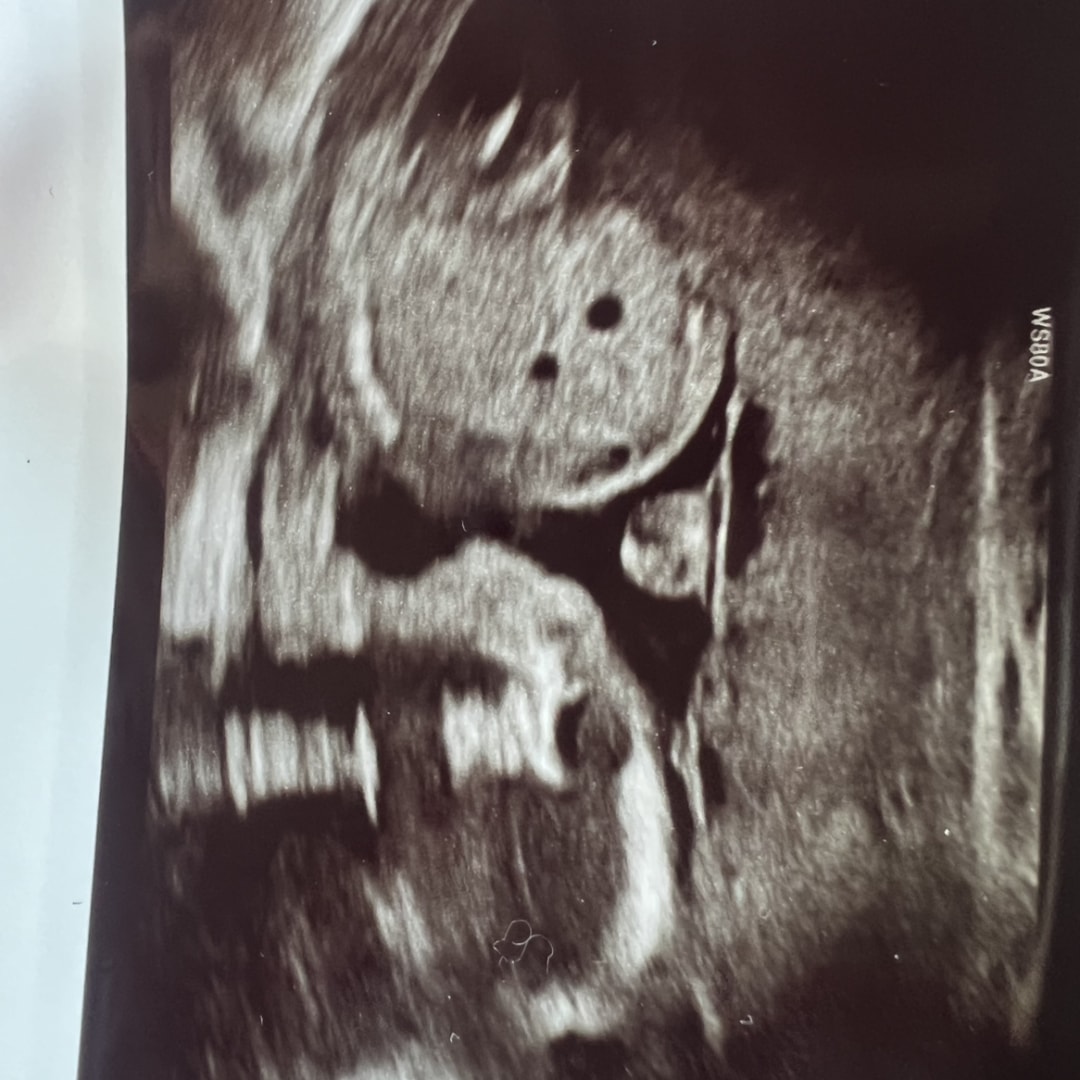 Photo shared by Rissa for their Babylist baby registry.