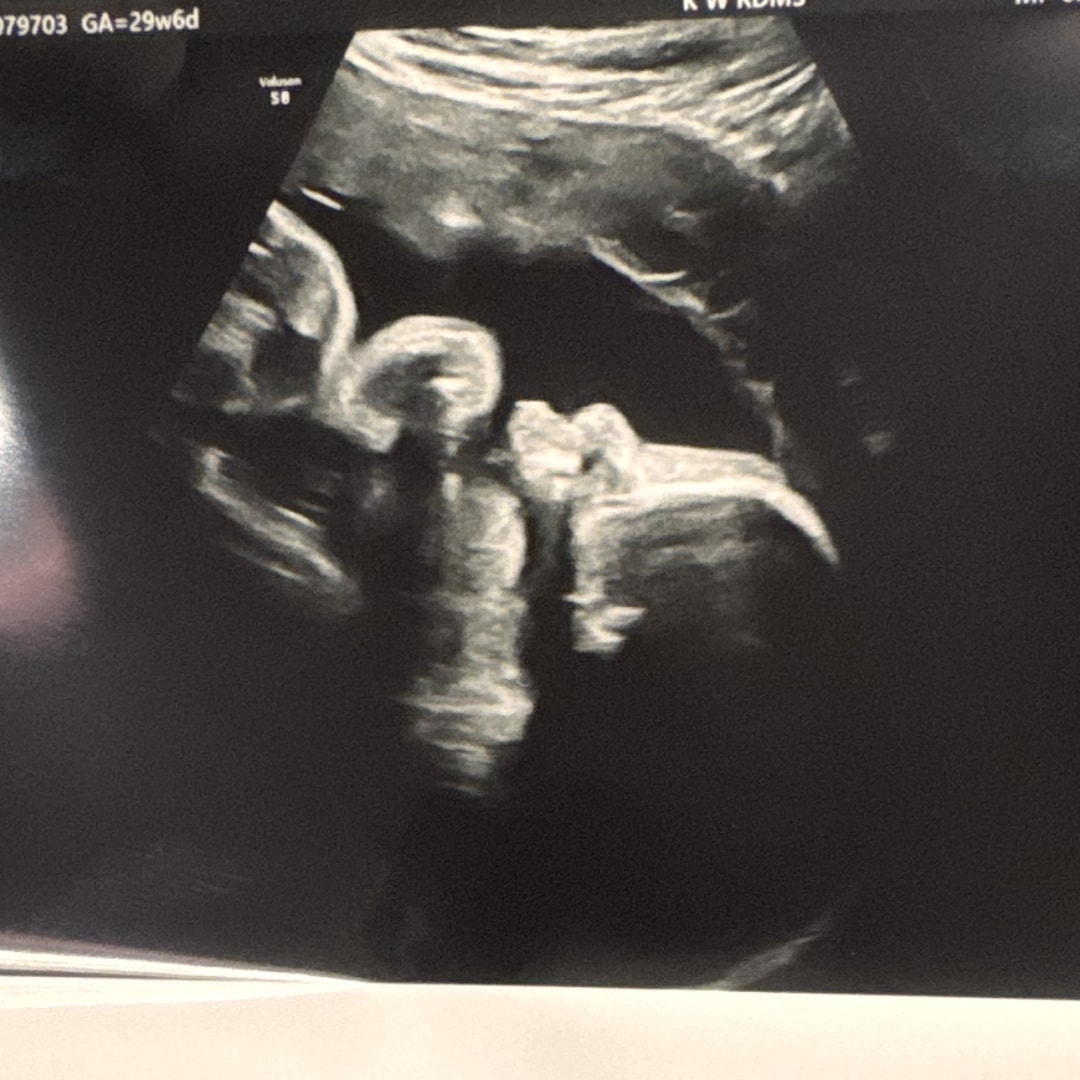 Photo shared by Alli for their Babylist baby registry.
