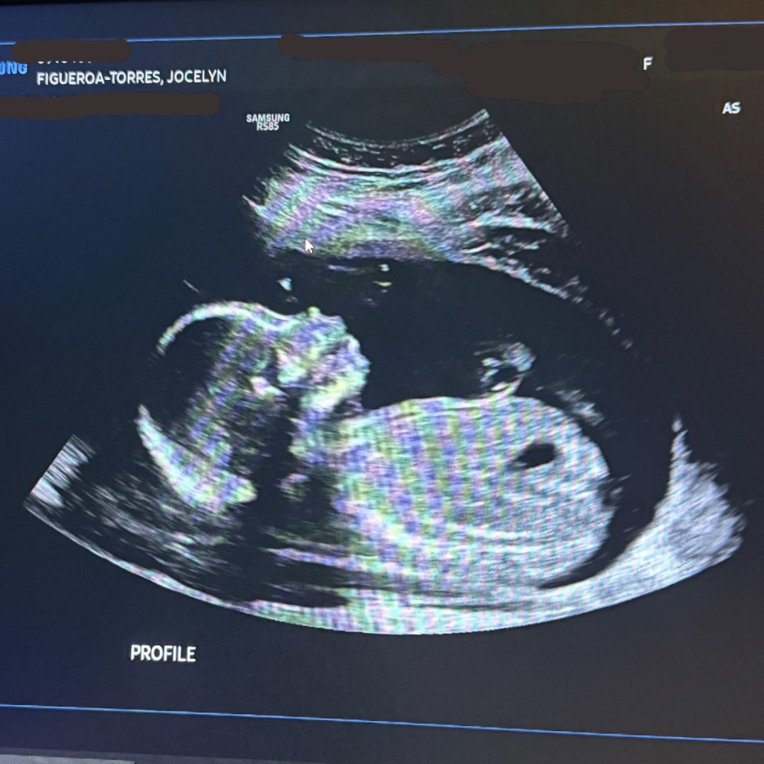 Photo shared by Jocelyn for their Babylist baby registry.