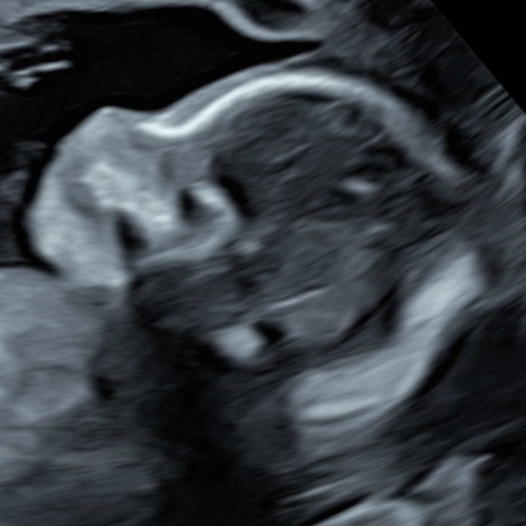 Photo shared by Keyla for their Babylist baby registry.