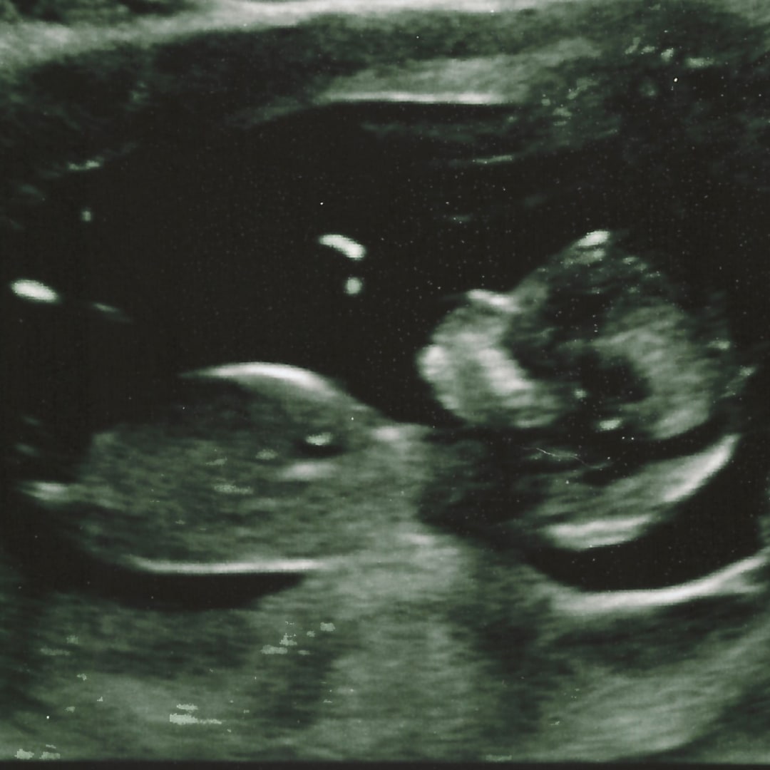 Photo shared by Allison for their Babylist baby registry.