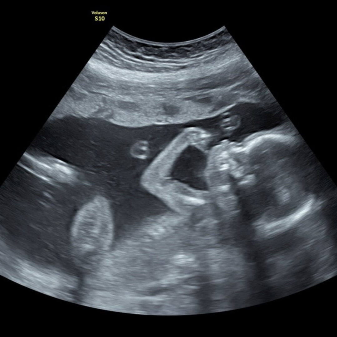 Photo shared by Alyssa for their Babylist baby registry.