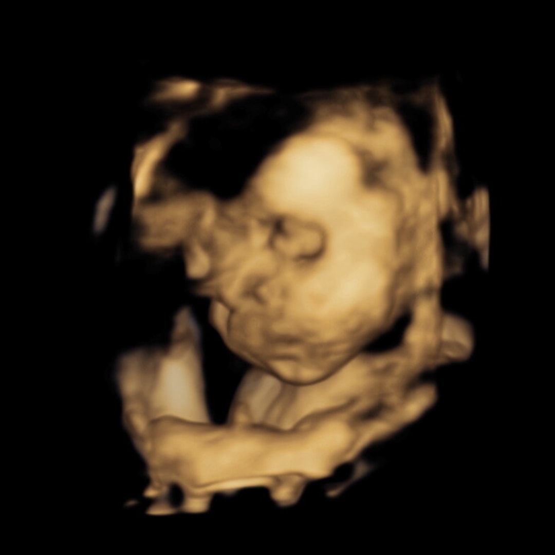 Photo shared by Iria for their Babylist baby registry.