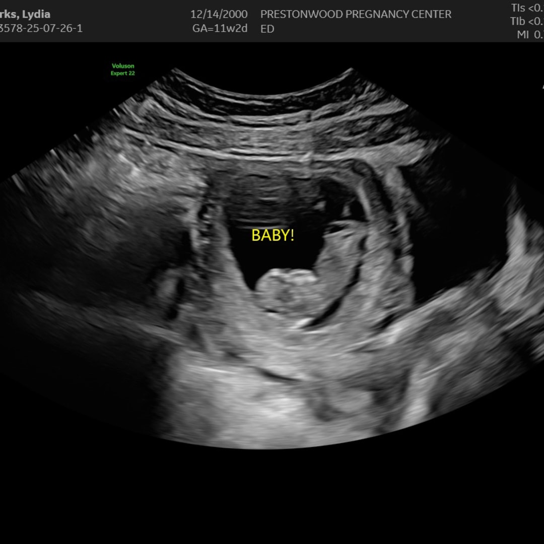 Photo shared by Lydia for their Babylist baby registry.