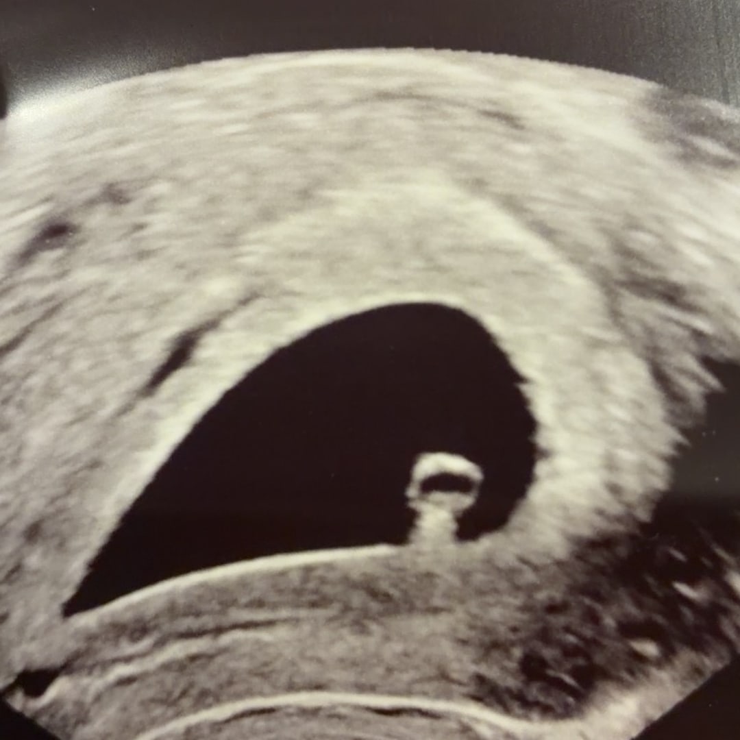 Photo shared by Kelsie for their Babylist baby registry.