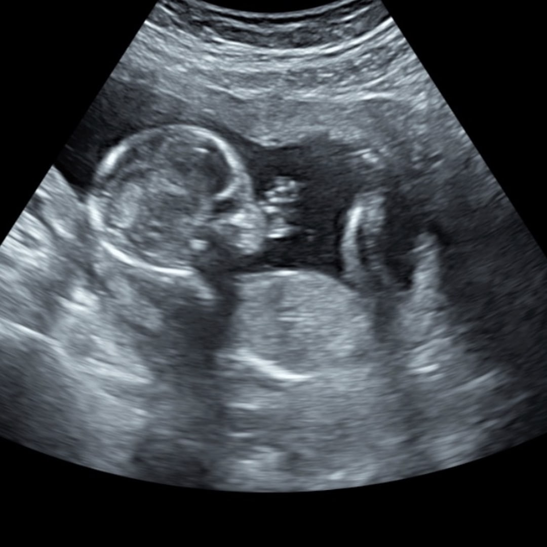 Photo shared by Dayna for their Babylist baby registry.