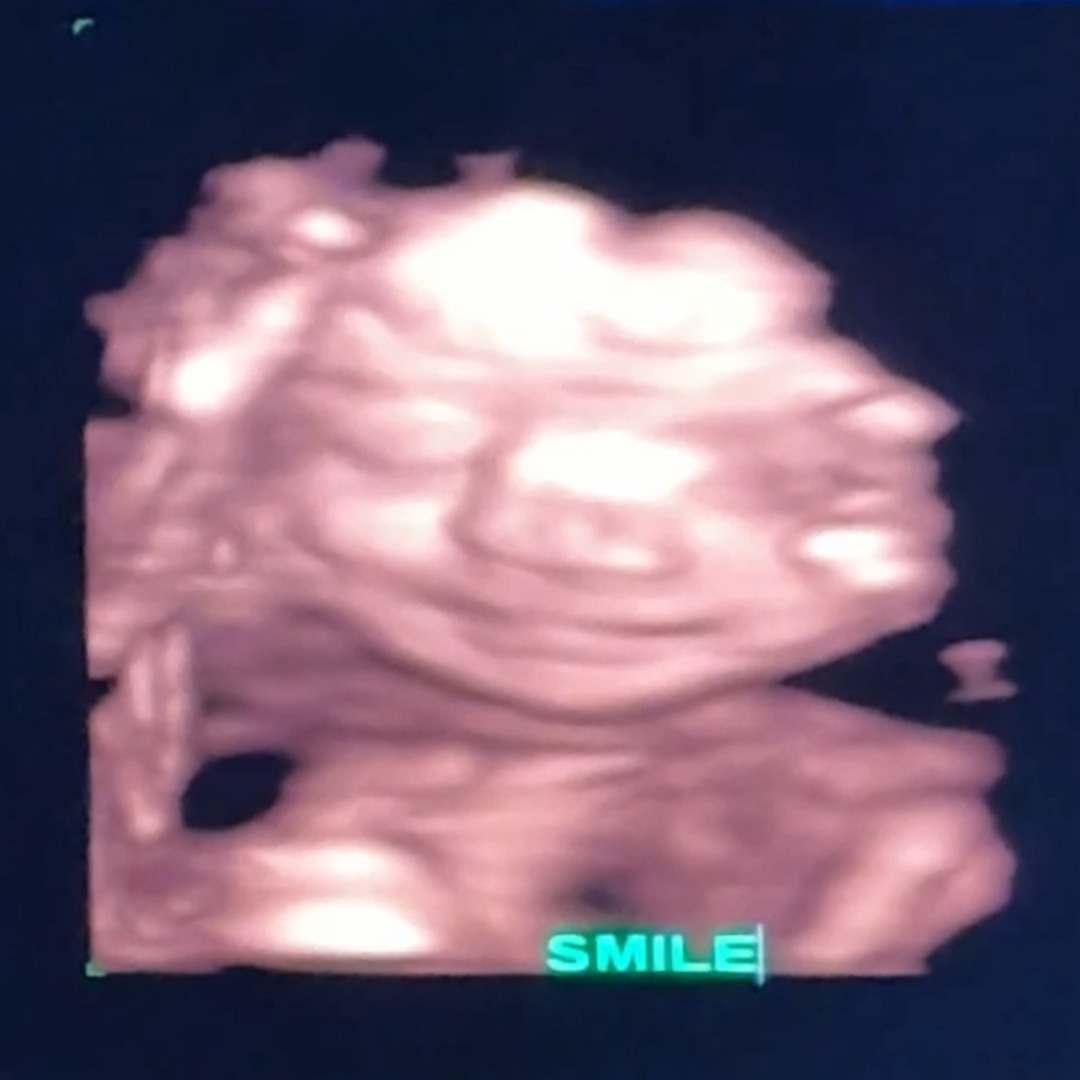 Photo shared by Keleigh for their Babylist baby registry.