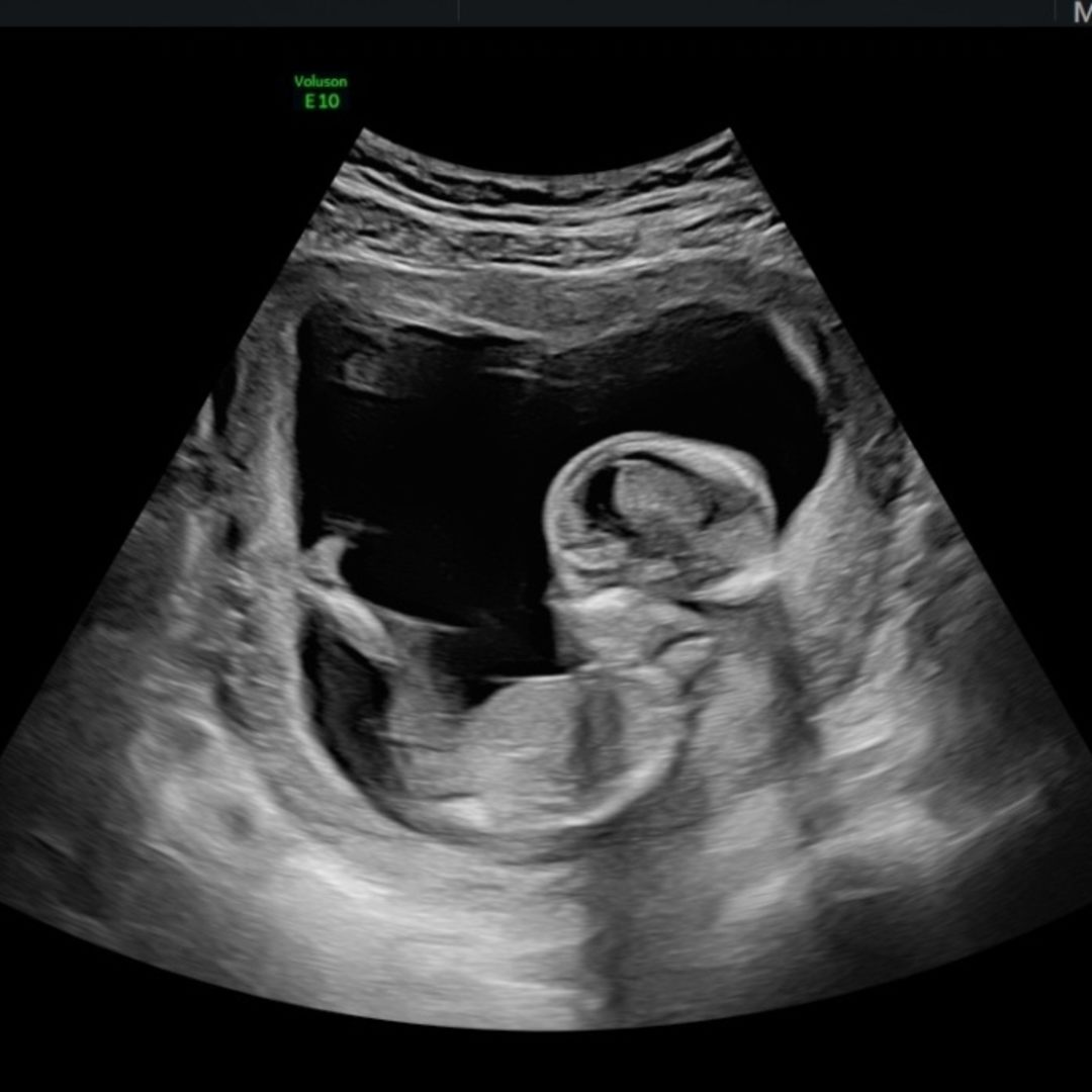 Photo shared by Abby for their Babylist baby registry.