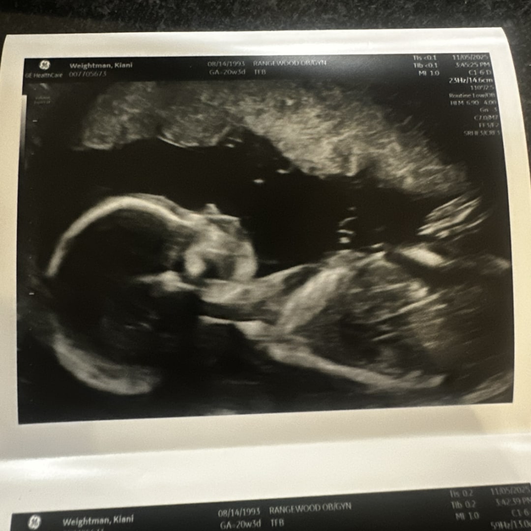 Photo shared by Kiani for their Babylist baby registry.